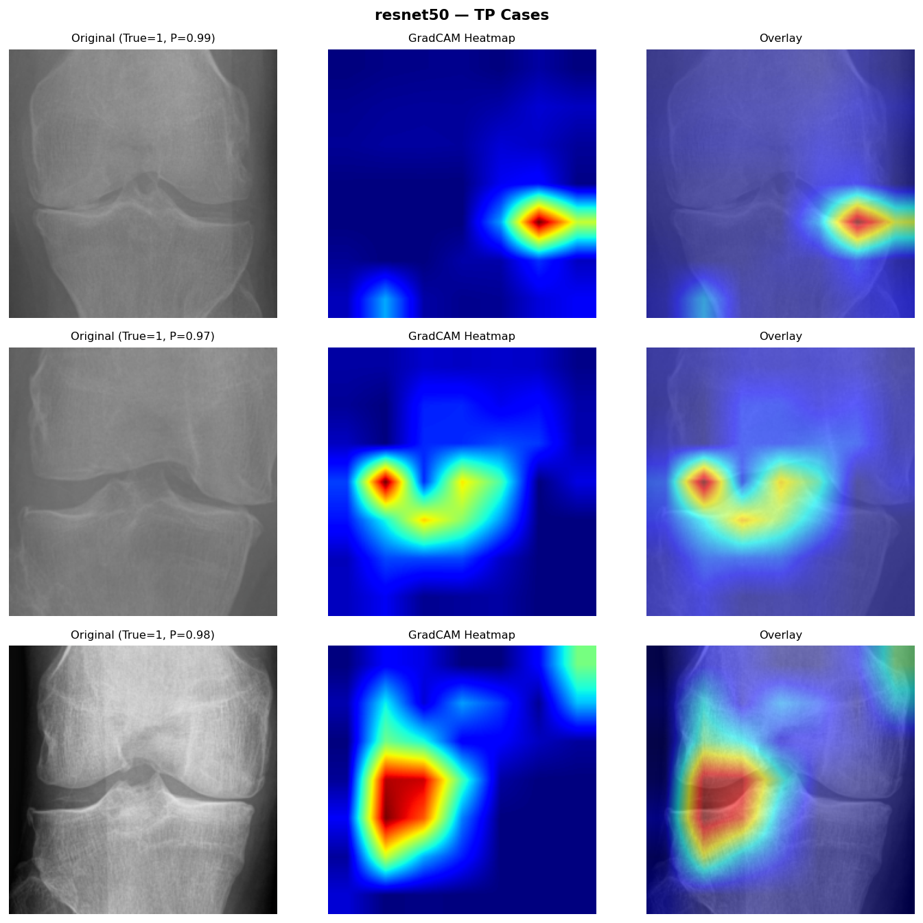 Knee OA detection model results and comparison